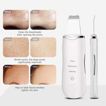 Ultrasonic Face Scrubber – Deep Clean Skin Exfoliator